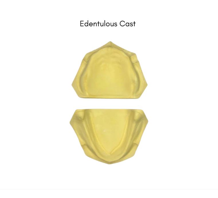 Edentulous Dental Casts (Upper & Lower)